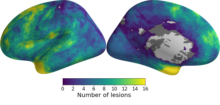 Two brain images with yellow regions in frontal and temporal cortex indicating high numbers of participants with cortical lesions in those regions, and blue regions elsewhere indicating fewer participatns with lesions in primary motor and sensory regions.